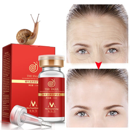 Anti-Acne Snail Repair Serum 12ml by HitMyNeed