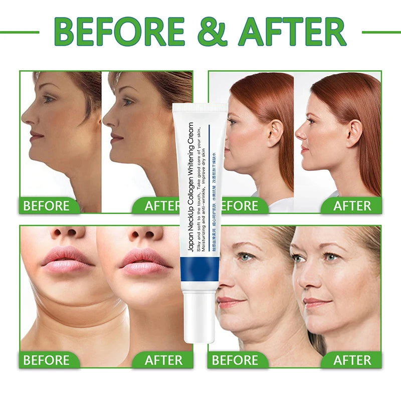 Anti-Aging Collagen Neck Cream 20g by HitMyNeed