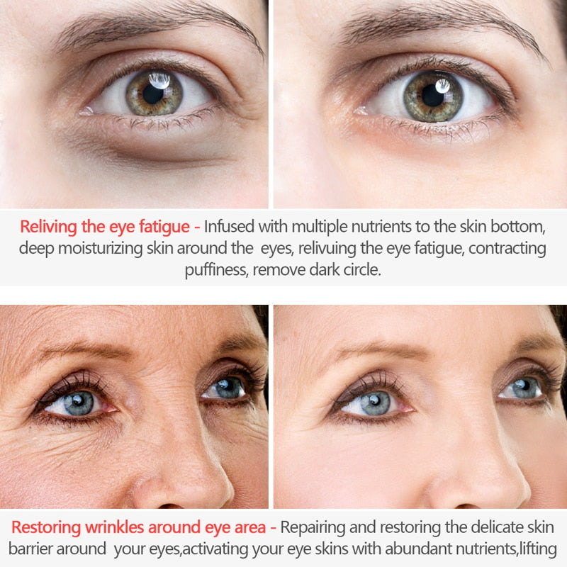 Anti Aging Eye Cream for Wrinkles and Fine Lines by HitMyNeed