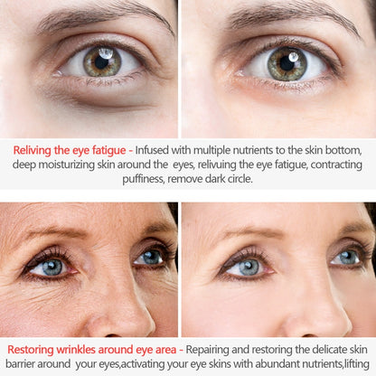 Anti Aging Eye Cream for Wrinkles and Fine Lines by HitMyNeed