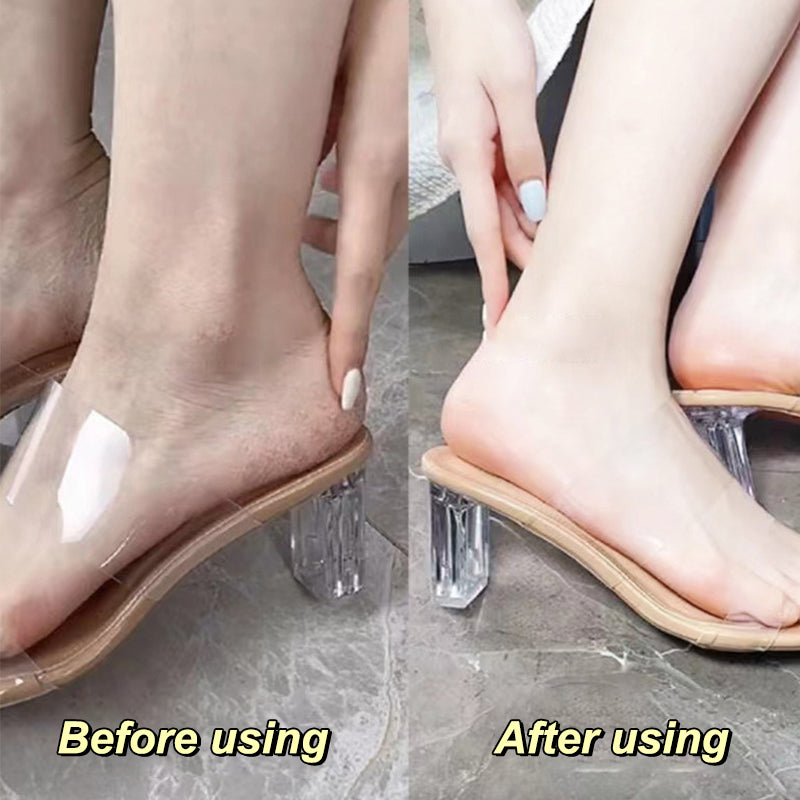 Anti-Dry Heel & Hand Repair Foot Cream Set by HitMyNeed