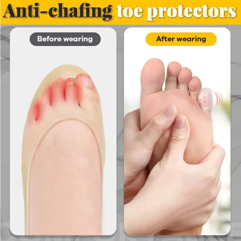 Anti-Friction Silicone Toe Caps (10 Pack) by HitMyNeed