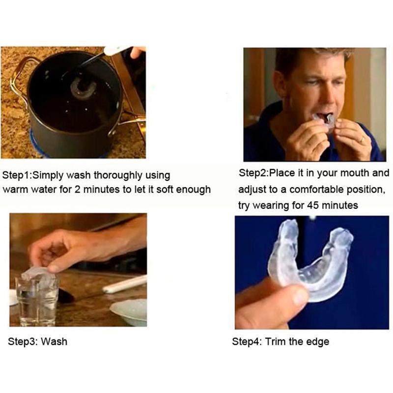 Anti Snore Mouth Guard Oral Appliance by HitMyNeed