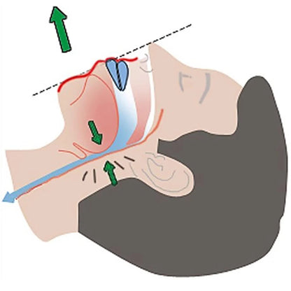Anti-Snoring & Bruxism Mouth Guard for Restful Sleep by HitMyNeed