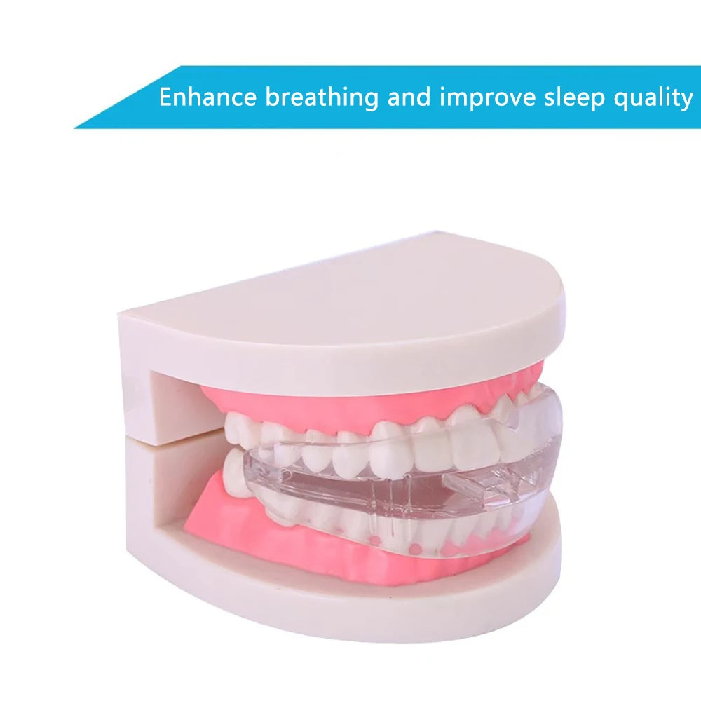Anti-Snoring & Bruxism Mouth Guard for Restful Sleep by HitMyNeed