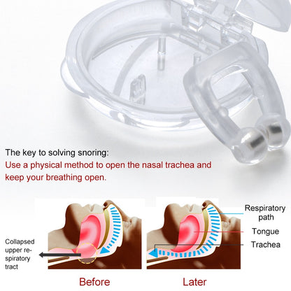 Anti Snoring Nose Clip Snore Stopper (2 Pcs) by HitMyNeed