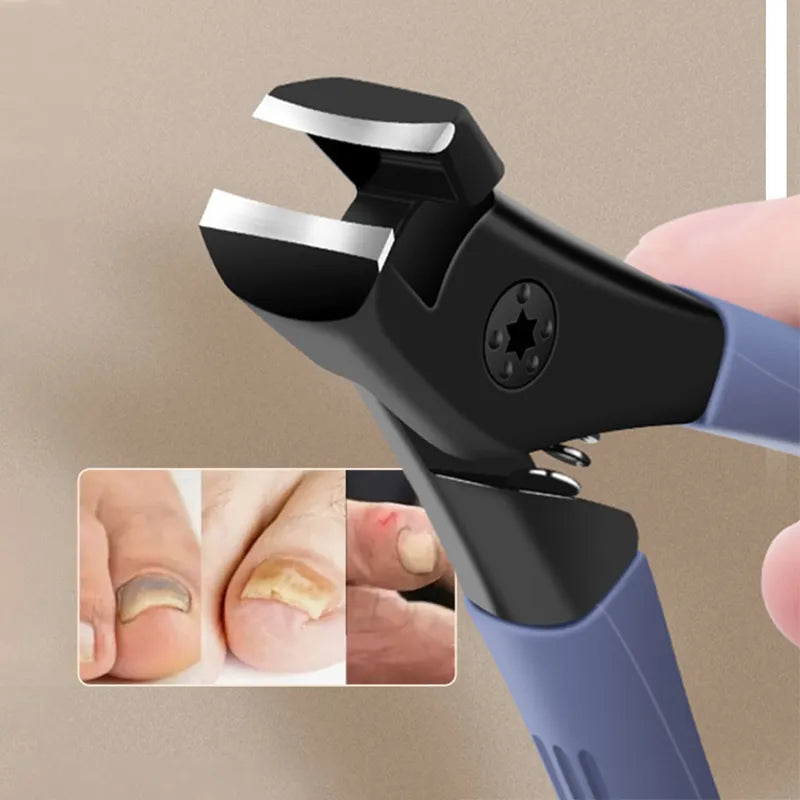 Anti-Splash Nail Clipper for Thick and Hard Nails by HitMyNeed