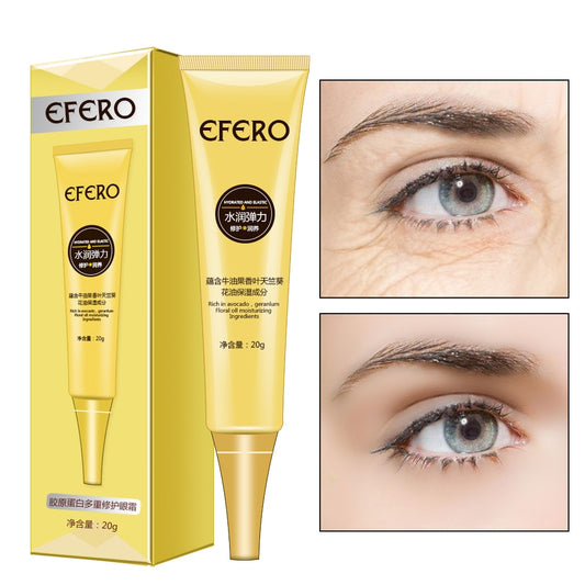 Anti Wrinkle Eye Cream with Hyaluronic Acid 20g by HitMyNeed