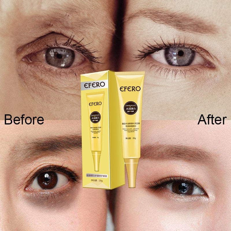 Anti Wrinkle Eye Cream with Hyaluronic Acid 20g by HitMyNeed
