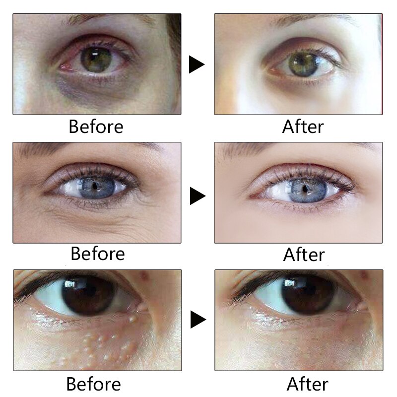 Anti Wrinkle Eye Cream with Hyaluronic Acid 20g by HitMyNeed