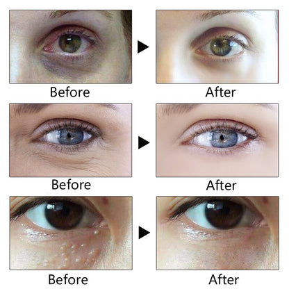 Anti Wrinkle Eye Cream with Hyaluronic Acid 20g by HitMyNeed