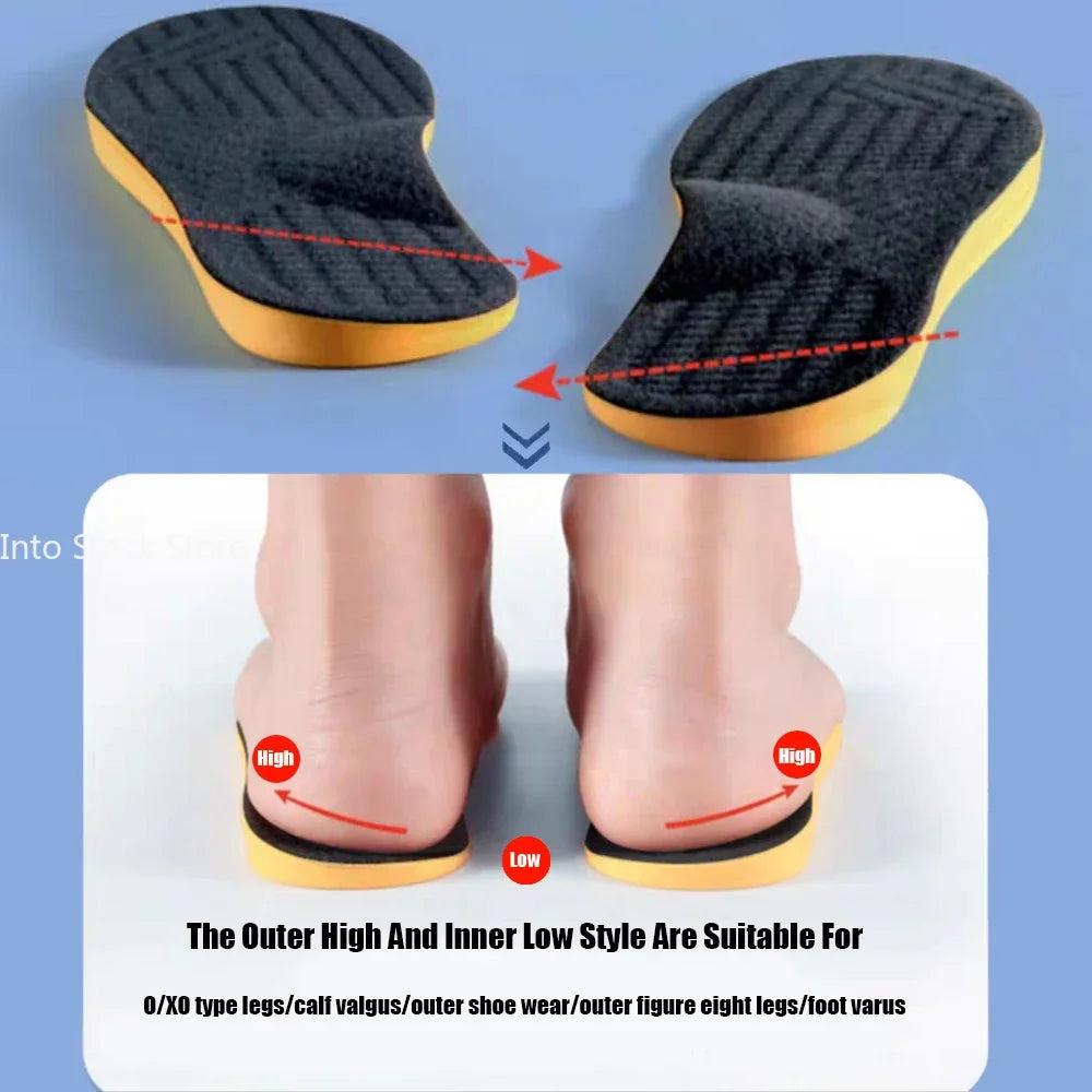 Arch Support Orthopedic Insoles for Flat Feet by HitMyNeed