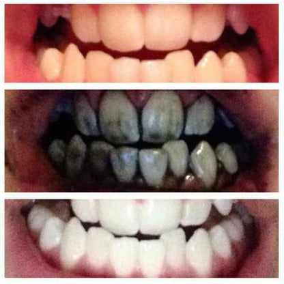 Bamboo Charcoal Teeth Whitening Toothpaste by HitMyNeed