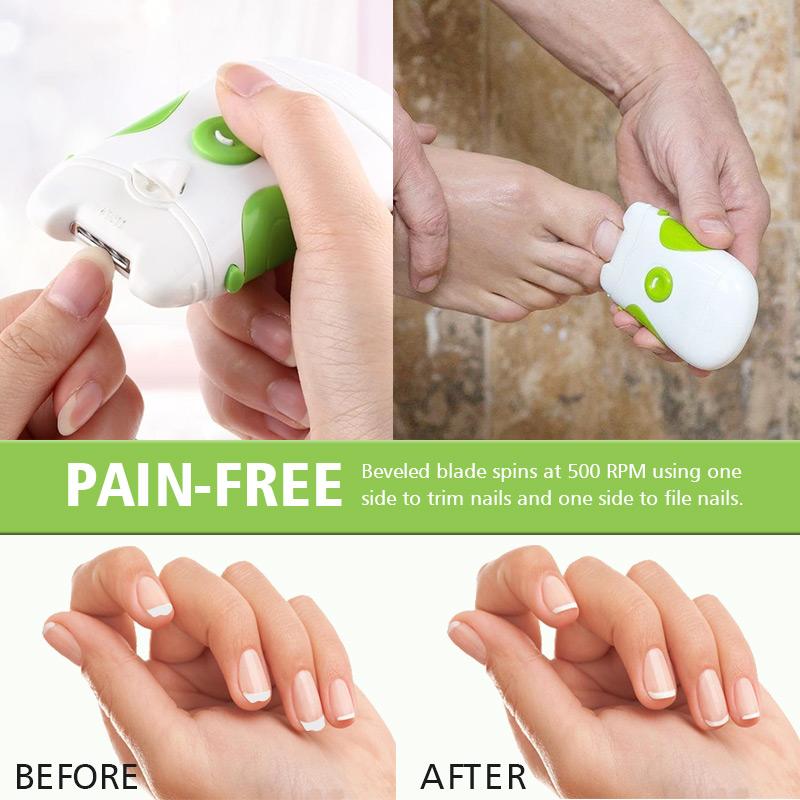 Battery Operated Electric Nail Clipper for Kids & Adults by HitMyNeed