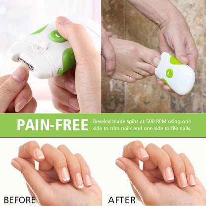 Battery Operated Electric Nail Clipper for Kids & Adults by HitMyNeed