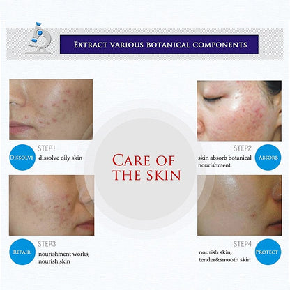 BioAqua Acne Treatment Skin Healer Cream 30g by HitMyNeed