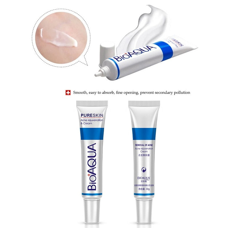 BioAqua Acne Treatment Skin Healer Cream 30g by HitMyNeed