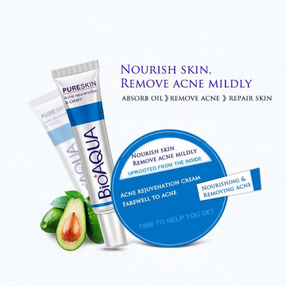 BioAqua Acne Treatment Skin Healer Cream 30g by HitMyNeed