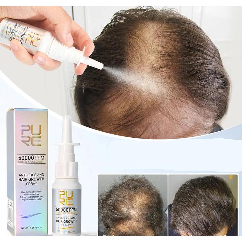 Biotin Hair Growth Spray for Thinning Hair 30ml by HitMyNeed