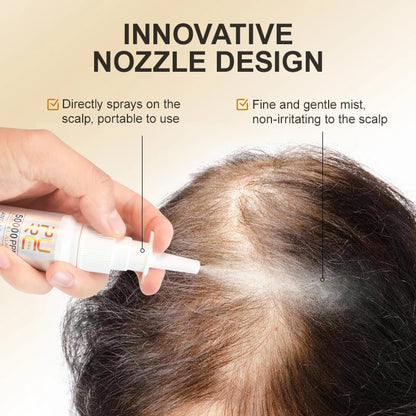 Biotin Hair Growth Spray for Thinning Hair 30ml by HitMyNeed