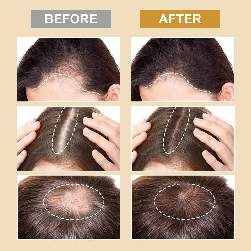 Biotin Hair Growth Spray for Thinning Hair 30ml by HitMyNeed