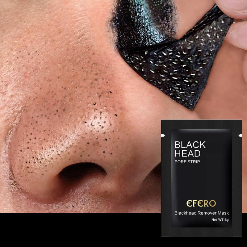 Blackhead Removal Face Mask Set of 5 by HitMyNeed