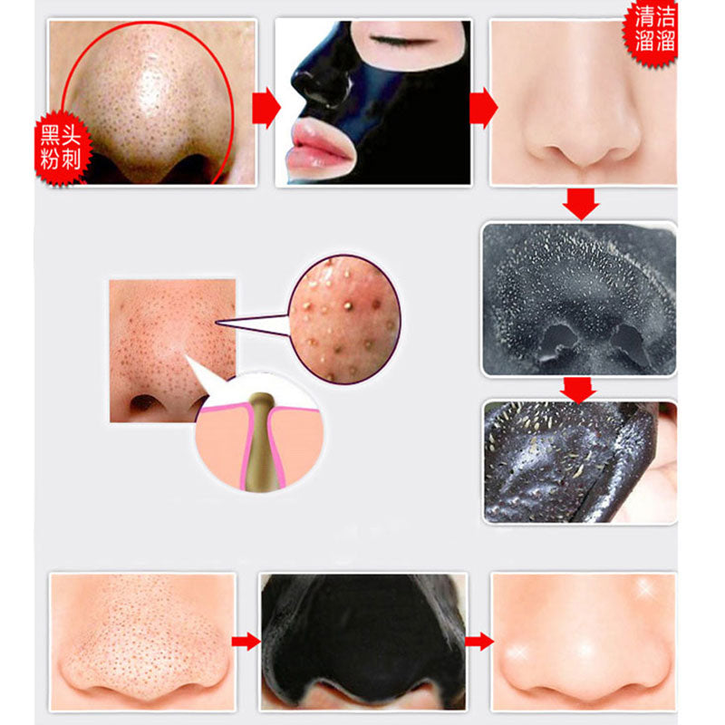 Blackhead Removal Face Mask Set of 5 by HitMyNeed