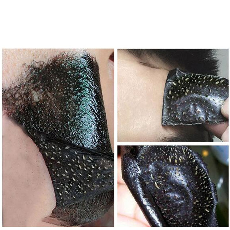 Blackhead Removal Face Mask Set of 5 by HitMyNeed