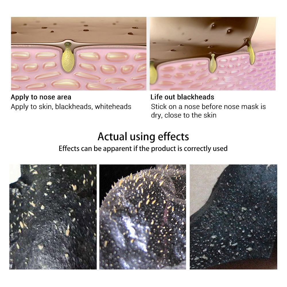Blackhead Removal Peel-Off Mask 50g by HitMyNeed