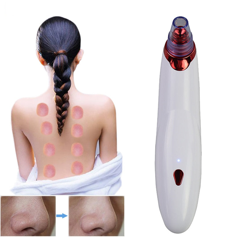Blackhead Removal Pore Cleaner with 4 Heads by HitMyNeed