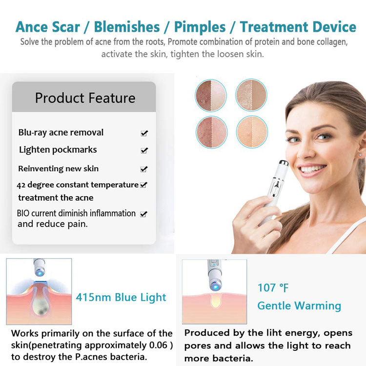 Blue Light Acne & Wrinkle Therapy Pen by HitMyNeed