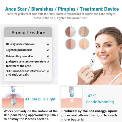 Blue Light Acne & Wrinkle Therapy Pen by HitMyNeed