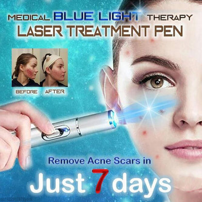 Blue Light Therapy Pen with Vein Care Cream by HitMyNeed
