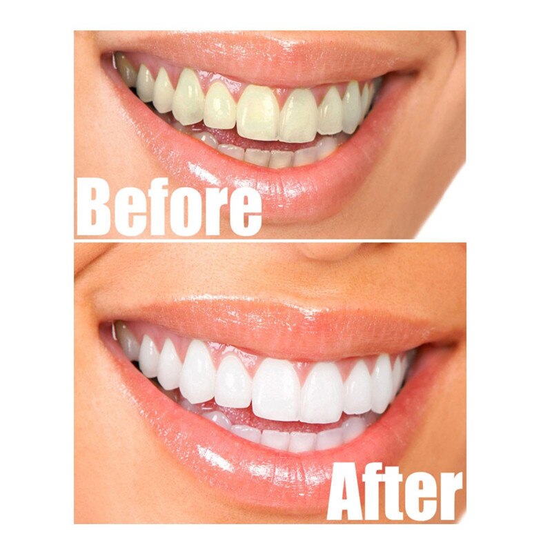 Charcoal Teeth Whitening Powder 30g by HitMyNeed