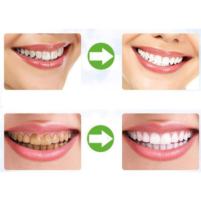 Charcoal Teeth Whitening Powder 30g by HitMyNeed