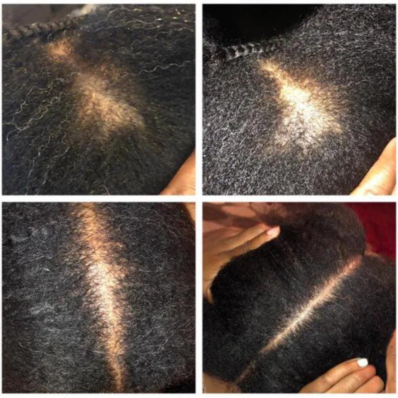 Chebe Powder Extraction Hair Oil for Breakage Control by HitMyNeed