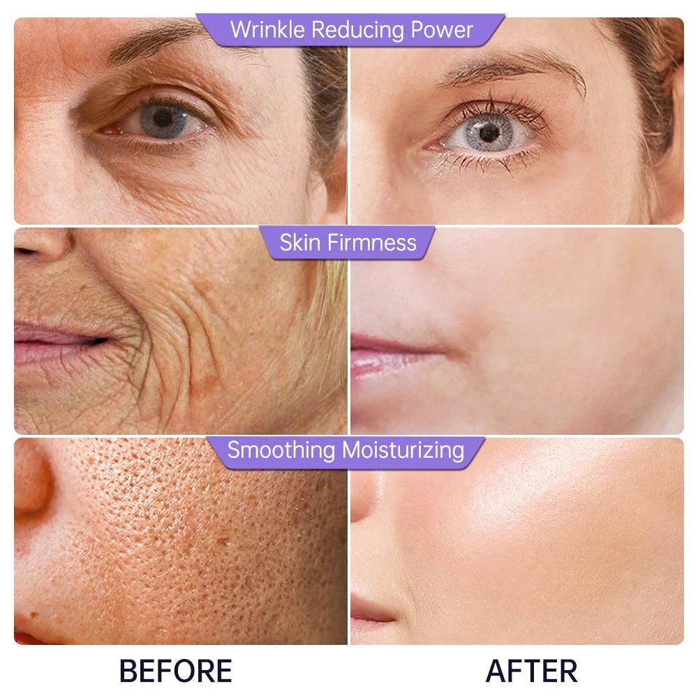 Collagen & Hyaluronic Acid Anti-Aging Face Serum by HitMyNeed