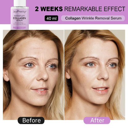 Collagen & Hyaluronic Acid Anti-Aging Face Serum by HitMyNeed