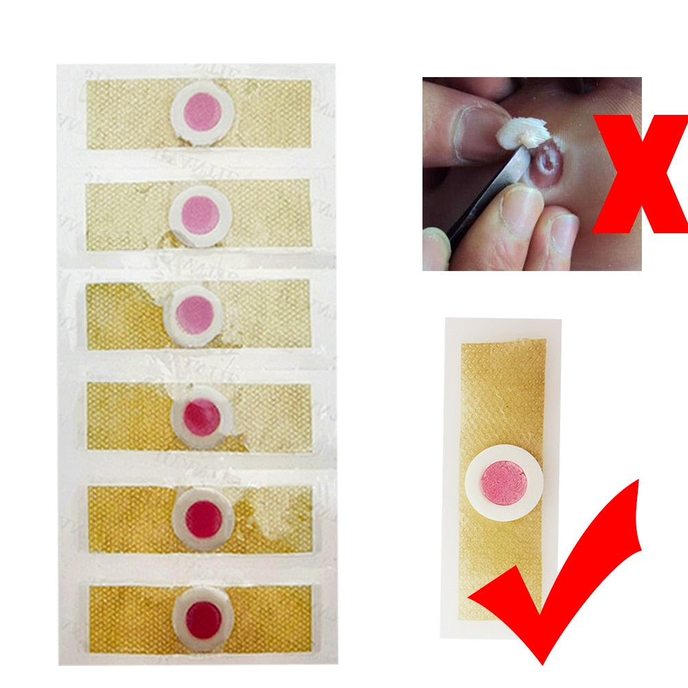 Corn Removal Pads for Foot Corn Relief (18 Pack) by HitMyNeed