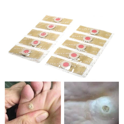 Corn Removal Patches for Feet, Medical Plaster, 60-Pack by HitMyNeed