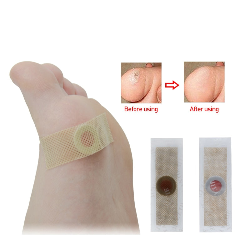 Corn Removal Patches for Feet, Medical Plaster, 60-Pack by HitMyNeed