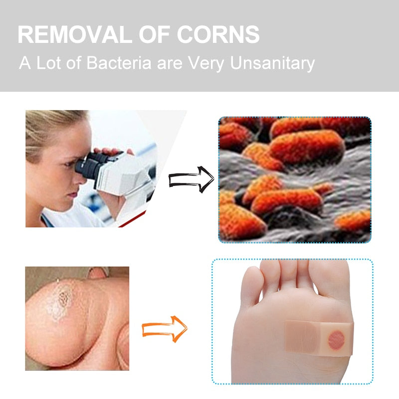 Corn Removal Patches for Feet, Medical Plaster, 60-Pack by HitMyNeed