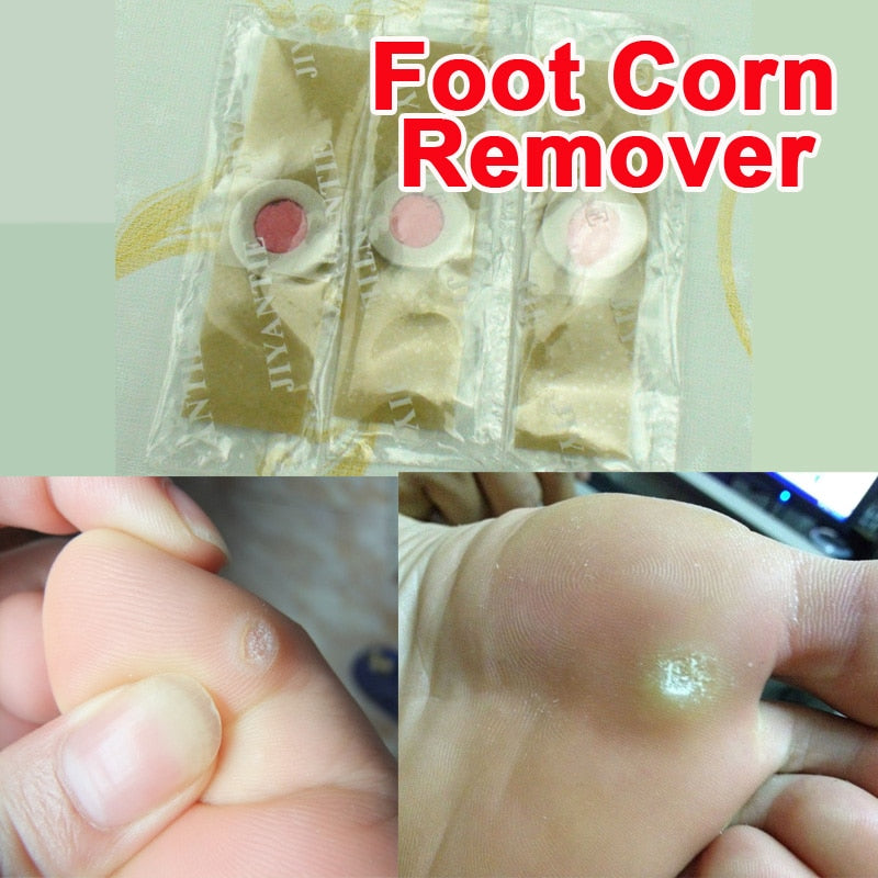 Corn Removal Plaster Strips, 24-Patch Pack by HitMyNeed