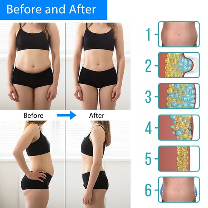 Cryotherapy Fat Freezing Anti-Cellulite Body Massager by HitMyNeed