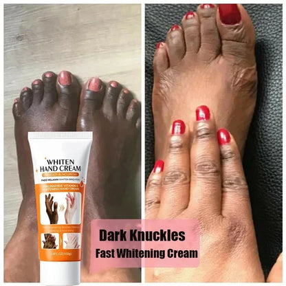 Dark Knuckles Brightening & Anti-Cracking Hand Serum 100g by HitMyNeed