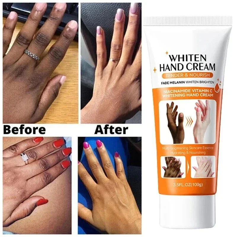 Dark Knuckles Brightening & Anti-Cracking Hand Serum 100g by HitMyNeed
