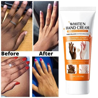 Dark Knuckles Brightening & Anti-Cracking Hand Serum 100g by HitMyNeed