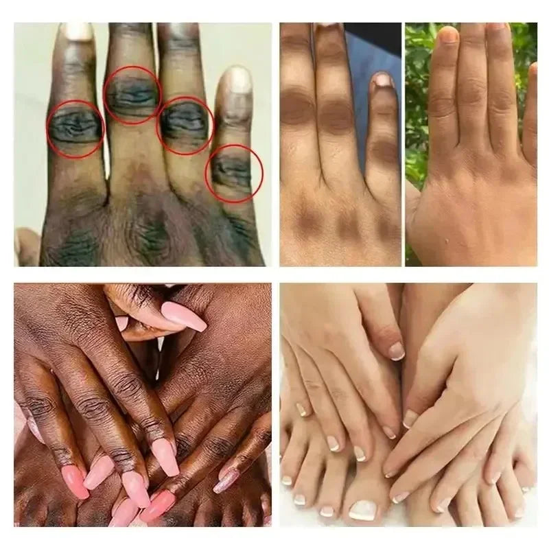 Dark Knuckles Brightening & Anti-Cracking Hand Serum 100g by HitMyNeed