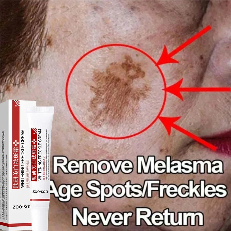 Dark Spot Corrector Gel with Niacinamide 20ml by HitMyNeed