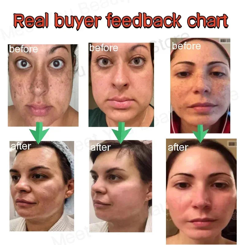 Dark Spot Corrector Gel with Niacinamide 20ml by HitMyNeed